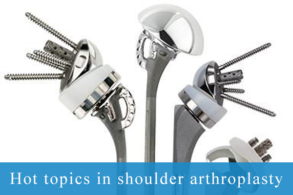 hot topics in shoulder arthroplasty